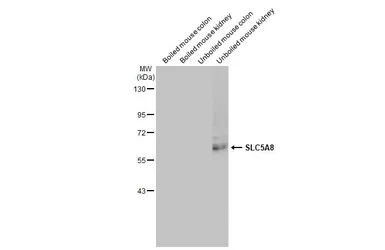 Anti-SLC5A8 antibody [HL2687] used in Western Blot (WB). GTX639352