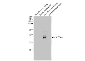 Anti-SLC5A8 antibody [HL2687] used in Western Blot (WB). GTX639352