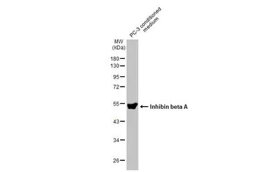 Anti-Inhibin beta A antibody [HL2696] used in Western Blot (WB). GTX639447