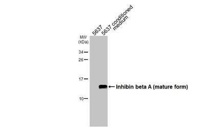 Anti-Inhibin beta A antibody [HL2696] used in Western Blot (WB). GTX639447