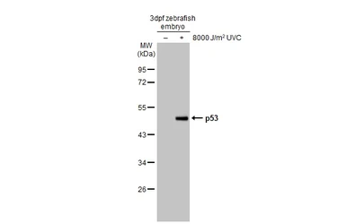 Anti-p53 antibody [HL2699] used in Western Blot (WB). GTX639450