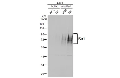 Anti-P2Y1 antibody [HL2702] used in Western Blot (WB). GTX639453