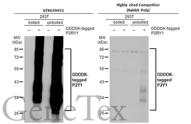 Anti-P2Y1 antibody [HL2702] used in Western Blot (WB). GTX639453