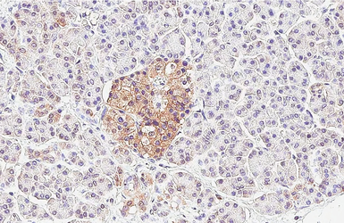 Anti-P2Y1 antibody [HL2702] used in IHC (Paraffin sections) (IHC-P). GTX639453