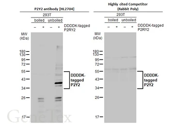 Anti-P2Y2 antibody [HL2704] used in Western Blot (WB). GTX639458
