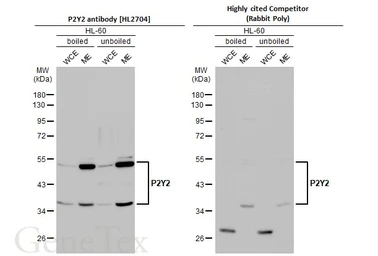 Anti-P2Y2 antibody [HL2704] used in Western Blot (WB). GTX639458