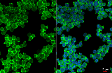 Anti-P2Y2 antibody [HL2704] used in Immunocytochemistry/ Immunofluorescence (ICC/IF). GTX639458