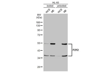 Anti-P2Y2 antibody [HL2704] used in Western Blot (WB). GTX639458