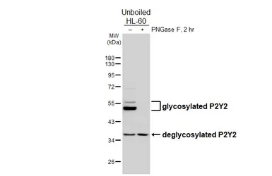 Anti-P2Y2 antibody [HL2704] used in Western Blot (WB). GTX639458