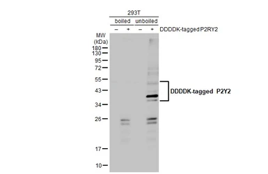 Anti-P2Y2 antibody [HL2704] used in Western Blot (WB). GTX639458