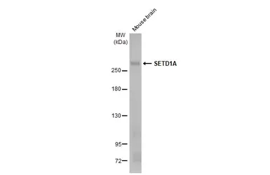 Anti-SETD1A antibody [HL2705] used in Western Blot (WB). GTX639459