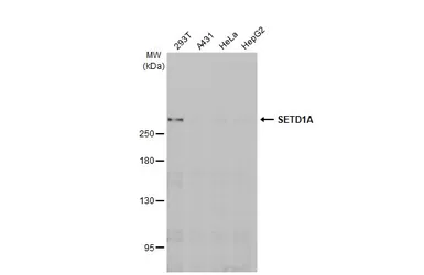 Anti-SETD1A antibody [HL2707] used in Western Blot (WB). GTX639461