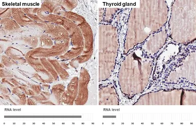 Anti-BCKDK antibody [HL2710] used in IHC (Paraffin sections) (IHC-P). GTX639471