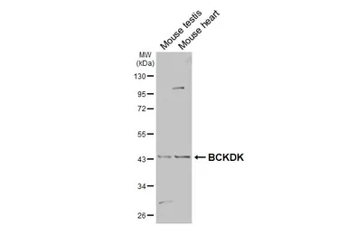 Anti-BCKDK antibody [HL2710] used in Western Blot (WB). GTX639471