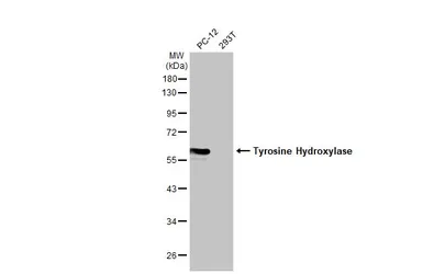 Anti-Tyrosine Hydroxylase antibody [HL2721] used in Western Blot (WB). GTX639548