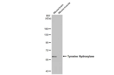 Anti-Tyrosine Hydroxylase antibody [HL2721] used in Western Blot (WB). GTX639548