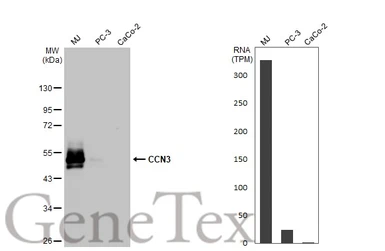 Anti-CCN3 antibody [HL2726] used in Western Blot (WB). GTX639554