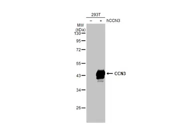 Anti-CCN3 antibody [HL2726] used in Western Blot (WB). GTX639554
