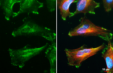 Anti-CCN3 antibody [HL2726] used in Immunocytochemistry/ Immunofluorescence (ICC/IF). GTX639554