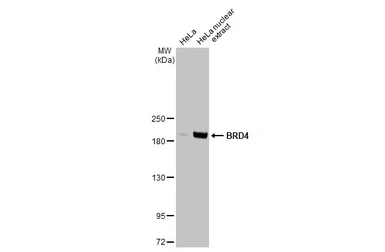 Anti-BRD4 antibody [HL2729] used in Western Blot (WB). GTX639557