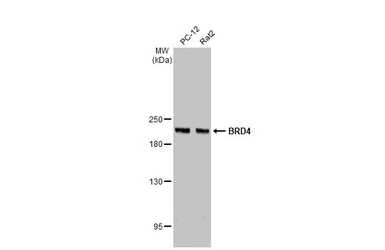 Anti-BRD4 antibody [HL2729] used in Western Blot (WB). GTX639557