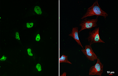 Anti-BRD4 antibody [HL2729] used in Immunocytochemistry/ Immunofluorescence (ICC/IF). GTX639557