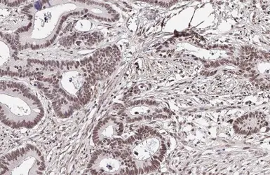 Anti-BRD4 antibody [HL2729] used in IHC (Paraffin sections) (IHC-P). GTX639557