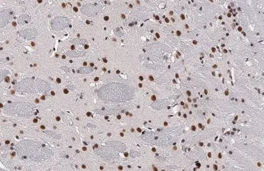 Anti-BRD4 antibody [HL2729] used in IHC (Paraffin sections) (IHC-P). GTX639557