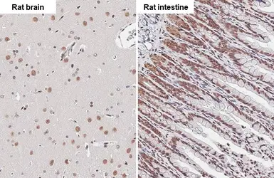 Anti-BRD4 antibody [HL2729] used in IHC (Paraffin sections) (IHC-P). GTX639557