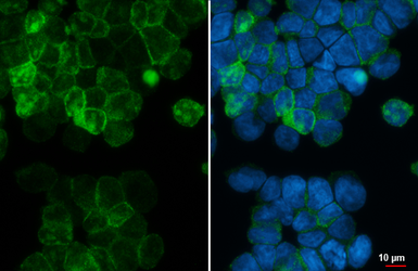 Anti-CXCR4 antibody [HL2734] used in Immunocytochemistry/ Immunofluorescence (ICC/IF). GTX639562