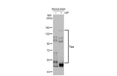 Anti-Tau antibody [HL2736] (GTX639564) | GeneTex