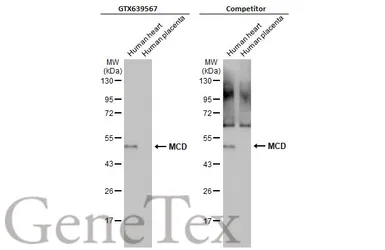 Anti-MCD antibody [HL2738] used in Western Blot (WB). GTX639567