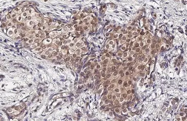 Anti-p38 MAPK (phospho Tyr182) antibody [HL2740] used in IHC (Paraffin sections) (IHC-P). GTX639569
