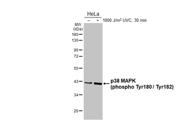 Anti-p38 MAPK (phospho Thr180 / Tyr182) antibody [HL2742] used in Western Blot (WB). GTX639571