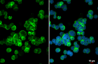Anti-C3a Receptor antibody [HL2744] used in Immunocytochemistry/ Immunofluorescence (ICC/IF). GTX639573