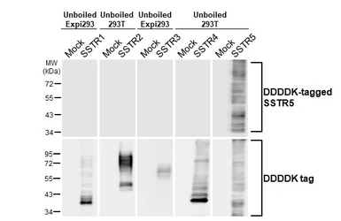 Anti-SSTR5 antibody [HL2756] used in Western Blot (WB). GTX639619