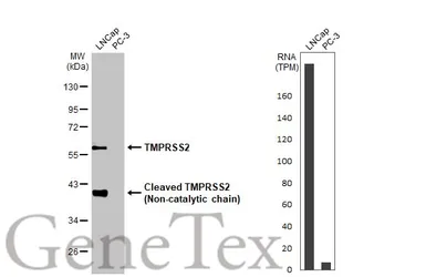 Anti-TMPRSS2 antibody [HL2759] used in Western Blot (WB). GTX639624