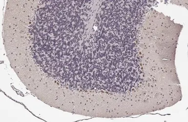 Anti-LIM1 antibody [HL2774] used in IHC (Paraffin sections) (IHC-P). GTX639639