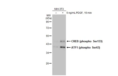 Anti-CREB (phospho Ser133) antibody [HL2776] used in Western Blot (WB). GTX639641