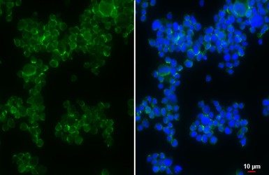 Anti-CCR5 antibody [HL2780] used in Immunocytochemistry/ Immunofluorescence (ICC/IF). GTX639645