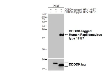 Anti-Human Papillomavirus type 18 E7 antibody [HL2787] used in Western Blot (WB). GTX639655