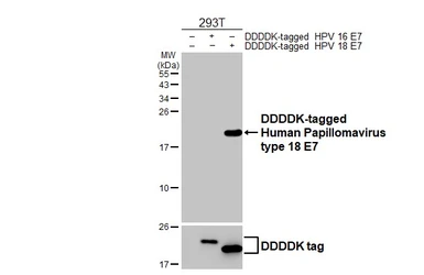 Anti-Human Papillomavirus type 18 E7 antibody [HL2788] used in Western Blot (WB). GTX639656