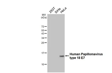 Anti-Human Papillomavirus type 18 E7 antibody [HL2788] used in Western Blot (WB). GTX639656