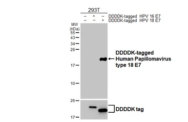 Anti-Human Papillomavirus type 18 E7 antibody [HL2789] used in Western Blot (WB). GTX639657