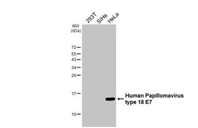 Anti-Human Papillomavirus type 18 E7 antibody [HL2789] used in Western Blot (WB). GTX639657