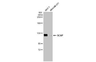Anti-SCAP antibody [HL2796] used in Western Blot (WB). GTX639684