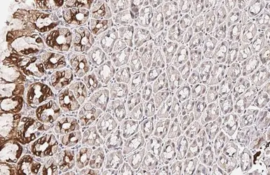 Anti-SCAP antibody [HL2796] used in IHC (Paraffin sections) (IHC-P). GTX639684