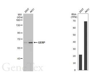 Anti-GERP antibody [HL2797] used in Western Blot (WB). GTX639685