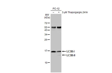 Anti-LC3B antibody [HL2798] used in Western Blot (WB). GTX639686