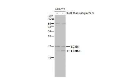 Anti-LC3B antibody [HL2798] used in Western Blot (WB). GTX639686